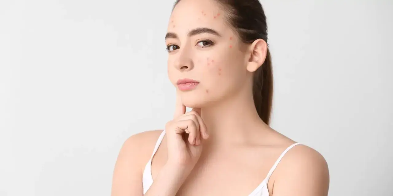 Młoda kobieta z wypryskami na twarzy, zastanawia się nad objawami uczulenia na zapachy.